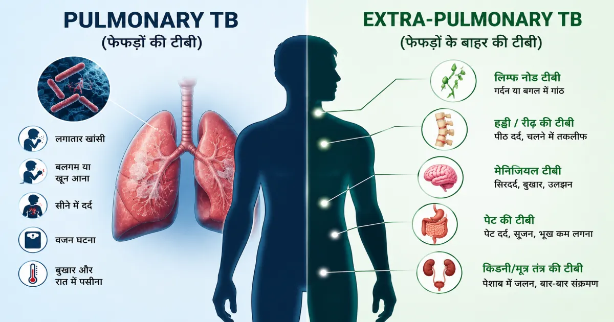 Pulmonary TB और Extra-Pulmonary TB में क्या अंतर है